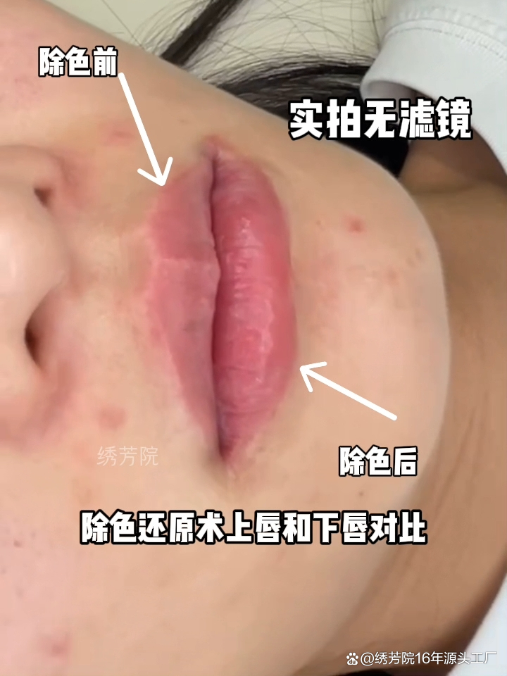自然美化脂酵素售价_自然美化脂酵素吃法_自然美化脂酵素订购电话