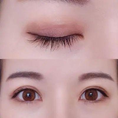 问鼎娱乐 最受欢迎的几个面部整形项目，哪个是你的最爱？