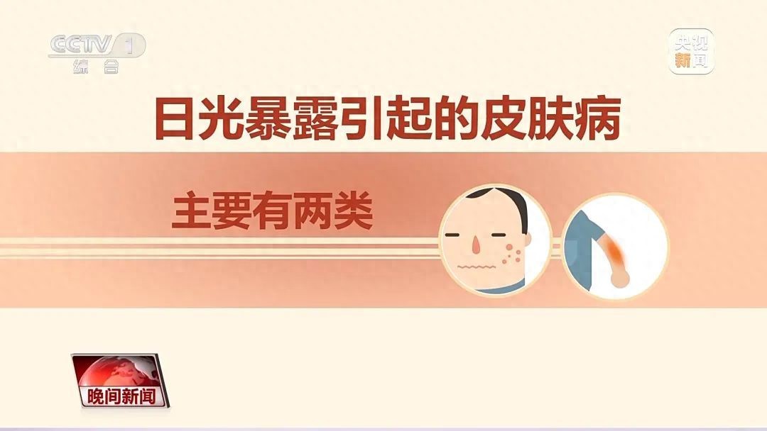 问鼎app官方下载 红肿、瘙痒……注意，你可能过敏啦！炎炎夏日，这些小知识请查收