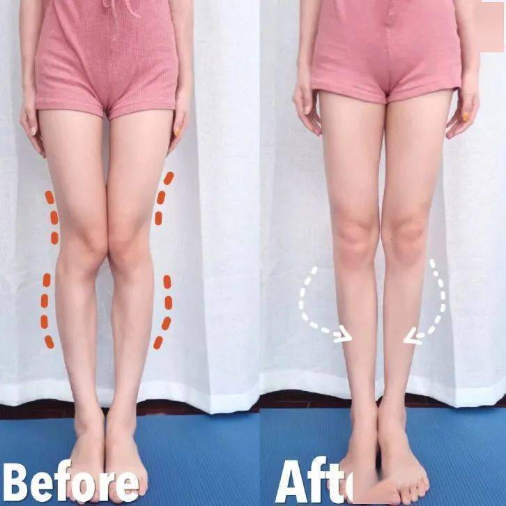 O型腿裤子推荐_根据腿型选裤子_正常腿型是什么样子的