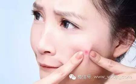 光子嫩肤适合人群_电波拉皮除皱做几次能除皱_光子嫩肤风险及注意事项