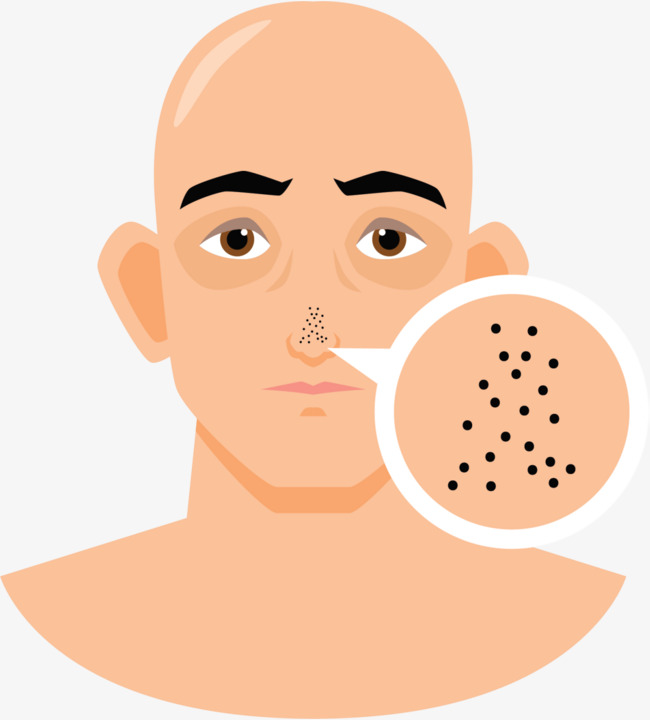 2025精准资料天天免费下载 用盐洗鼻子能去黑头吗？鼻子有黑头，试试这些小妙招！