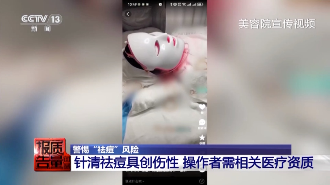 做面部清洁需要多少钱_美容院祛痘针清风险_祛痘治疗无证操作